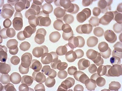 Sample image from Plasmodium Falciparum from Images of Giemsa for Malaria Detection