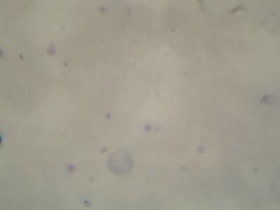 Sample image from Microscopy Malaria Dataset