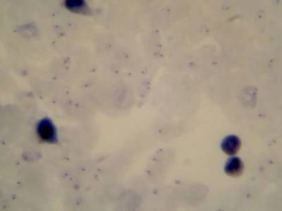 Sample image from Microscopy Malaria Dataset