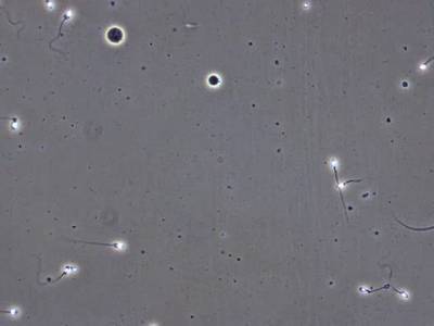 Sample image from VISEM-Tracking