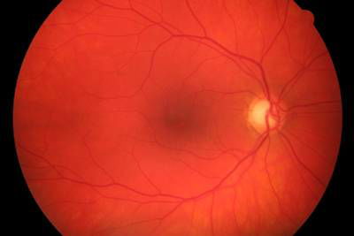 Sample image from High Resolution Fundus