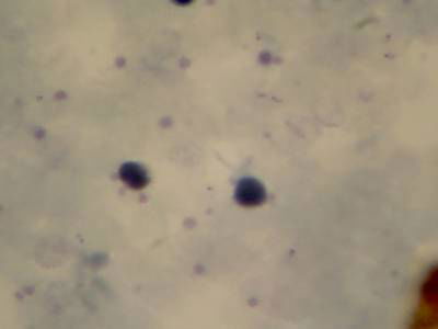 Sample image from Microscopy Malaria Dataset