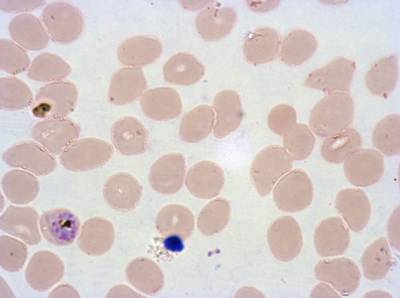 Sample image from Plasmodium Falciparum from Images of Giemsa for Malaria Detection