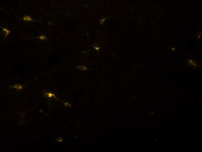 Sample image from Fluorescent Neuronal Cells