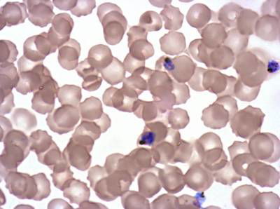Sample image from Plasmodium Falciparum from Images of Giemsa for Malaria Detection