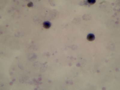 Sample image from Microscopy Malaria Dataset