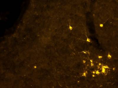 Sample image from Fluorescent Neuronal Cells