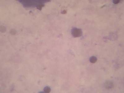 Sample image from Microscopy Malaria Dataset