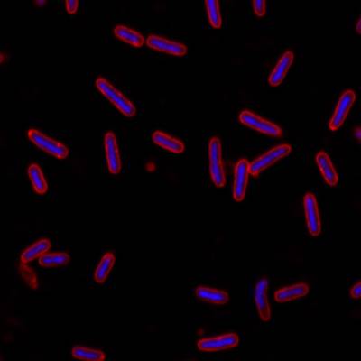 Sample image from DeepBacs E. Coli