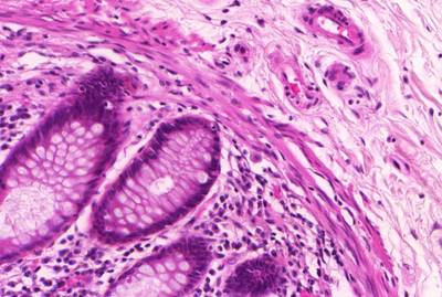 Sample image from GlaS@MICCAI'2015: Gland Segmentation