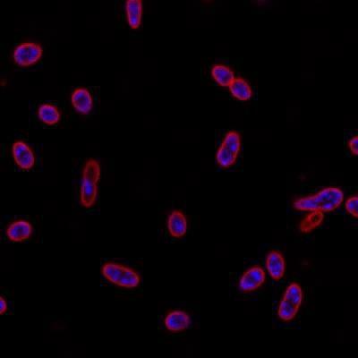 Sample image from DeepBacs E. Coli