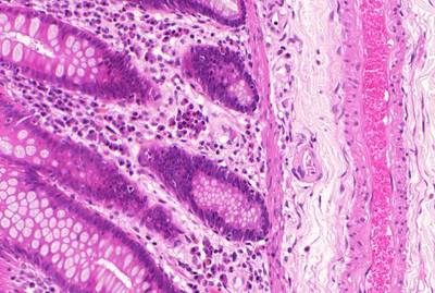 Sample image from GlaS@MICCAI'2015: Gland Segmentation