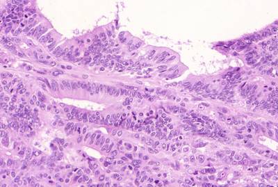 Sample image from GlaS@MICCAI'2015: Gland Segmentation