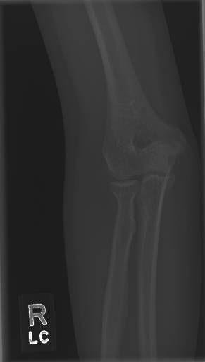 Sample image from Bone Classification and Detection Dataset