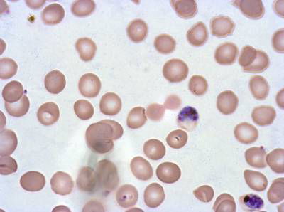 Sample image from Plasmodium Falciparum from Images of Giemsa for Malaria Detection