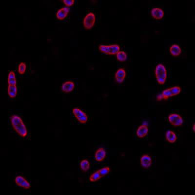 Sample image from DeepBacs E. Coli