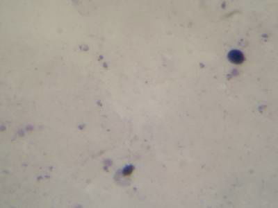 Sample image from Microscopy Malaria Dataset