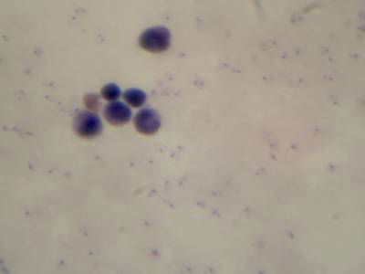 Sample image from Microscopy Malaria Dataset