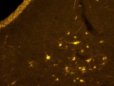 Sample image from Fluorescent Neuronal Cells