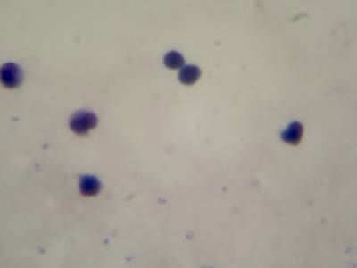 Sample image from Microscopy Malaria Dataset