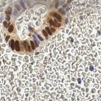 Sample image from EndoNuke