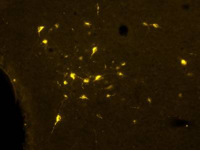 Sample image from Fluorescent Neuronal Cells