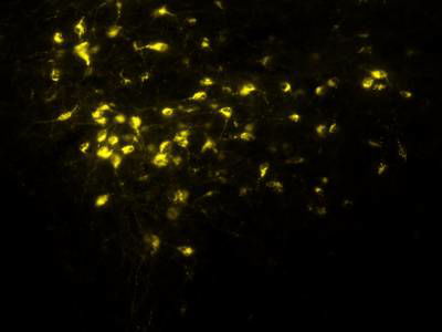 Sample image from Fluorescent Neuronal Cells