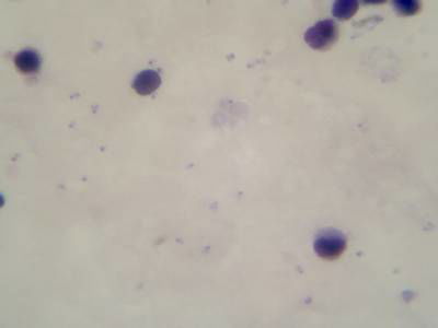 Sample image from Microscopy Malaria Dataset