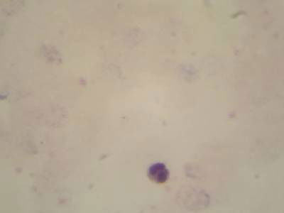 Sample image from Microscopy Malaria Dataset