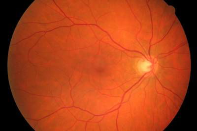 Sample image from High Resolution Fundus