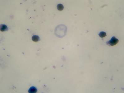 Sample image from Microscopy Malaria Dataset