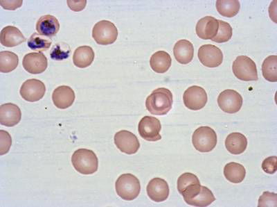 Sample image from Plasmodium Falciparum from Images of Giemsa for Malaria Detection