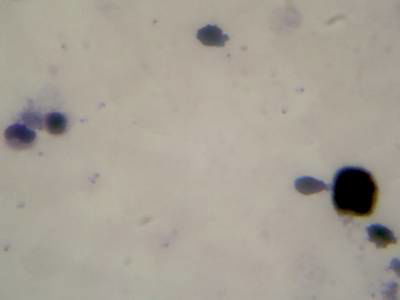 Sample image from Microscopy Malaria Dataset