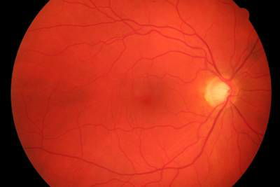 Sample image from High Resolution Fundus