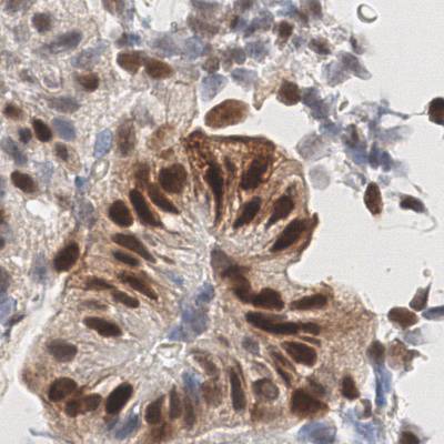 Sample image from EndoNuke