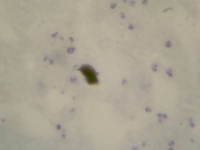 Sample image from Microscopy Malaria Dataset