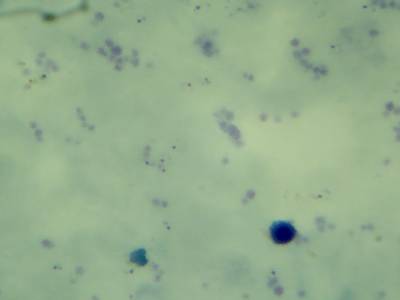 Sample image from Microscopy Malaria Dataset