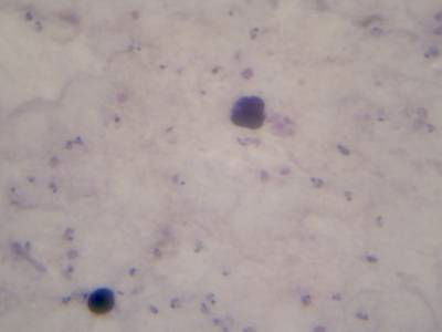 Sample image from Microscopy Malaria Dataset