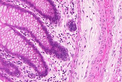 Sample image from GlaS@MICCAI'2015: Gland Segmentation