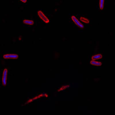 Sample image from DeepBacs E. Coli