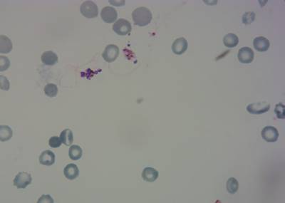 Sample image from P. Vivax (Malaria) Infected Human Blood Smears