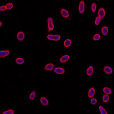 Sample image from DeepBacs E. Coli