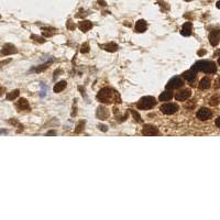 Sample image from EndoNuke