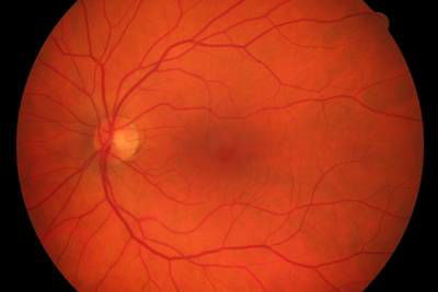 Sample image from High Resolution Fundus