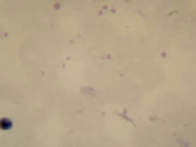 Sample image from Microscopy Malaria Dataset