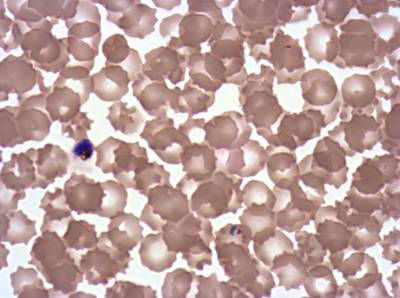 Sample image from Plasmodium Falciparum from Images of Giemsa for Malaria Detection